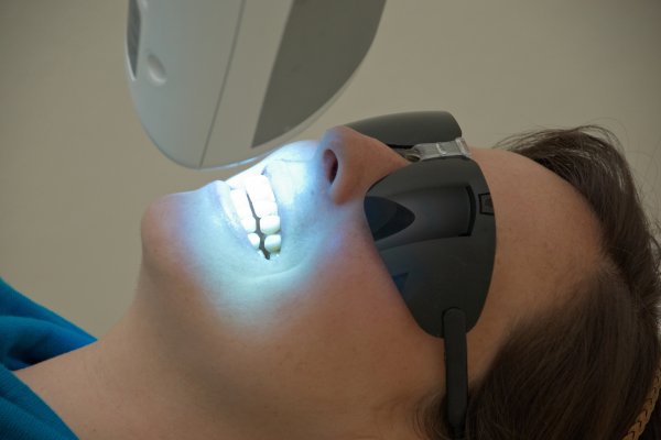 Whitening Traumatized Teeth