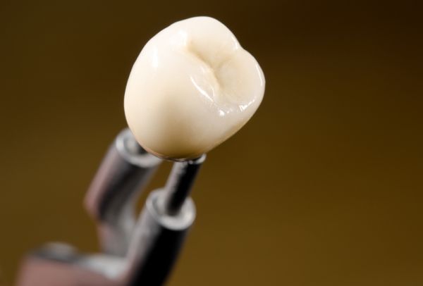 Dental Crown Options And Their Advantages
